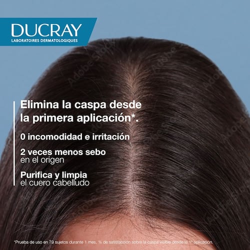 Ducray Kelual Squanorm Shampoo Caspa Grasa 200ml
