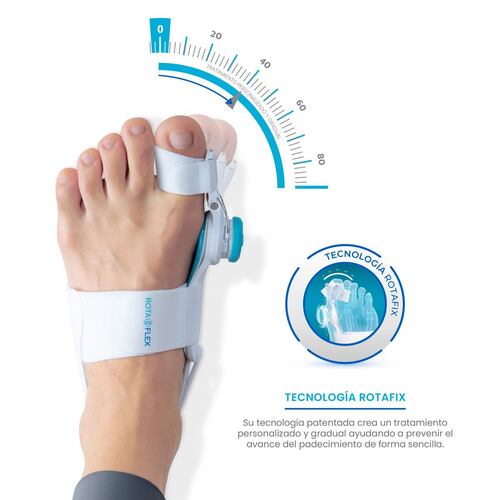 Rotaflex Tratamiento para Juanetes