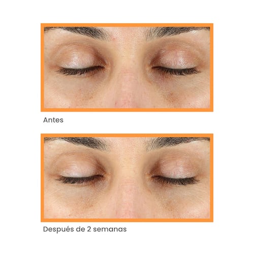 Murad Vita-C Eyes Dark Circle Corrector 15ml