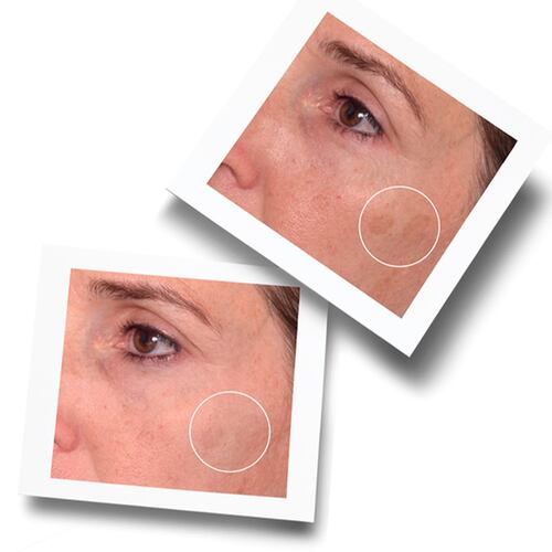Murad Rapid Dark Spot Correcting Serum 30ml