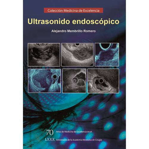 Ultrasonido endoscópico