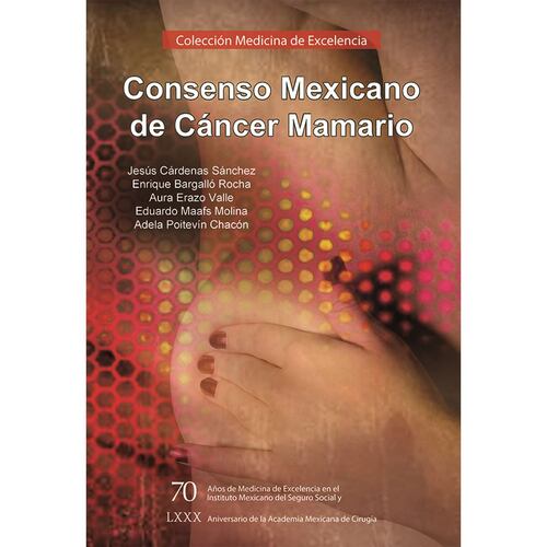 Consenso Mexicano de Cáncer Mamario