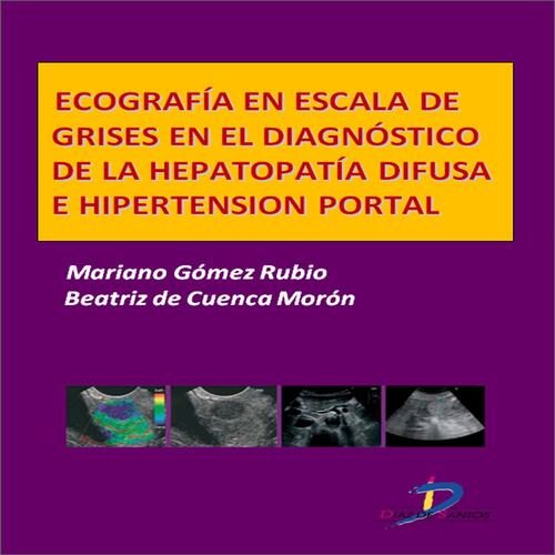 Ecografía en escala de grises en el diagnóstico de la hepatopatía difusa e hipertensión portal