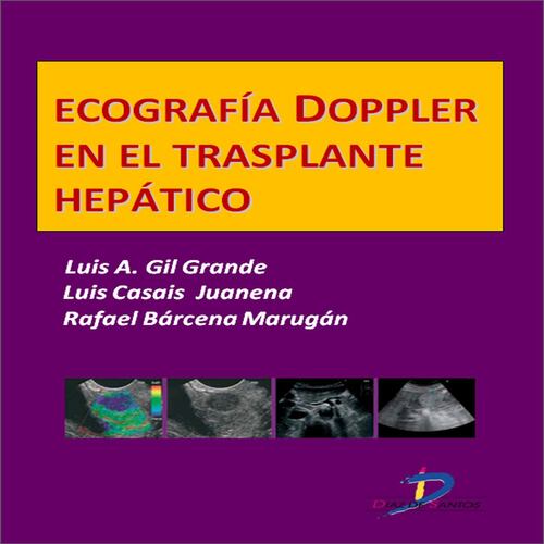 Ecografía Dopple en el trasplante hepático