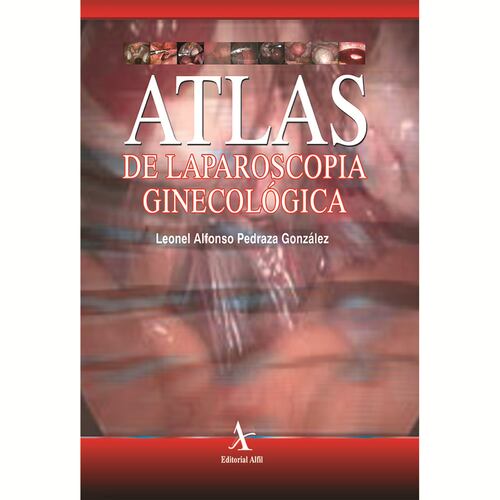 Atlas de laparoscopia ginecológica