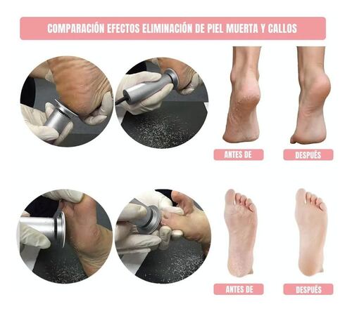 Máquinas Exfoliadoras Removedor De Callos Lima Para Pies Gris