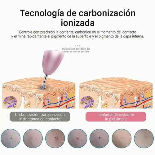 Pluma Cauterizador 9 En 1 Con Luz Azul Para Pecas Y Lunares Rosa