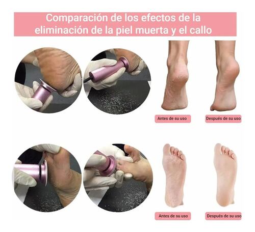 Removedor De Callos Profesional Electrico Exfoliante De Pies Negro