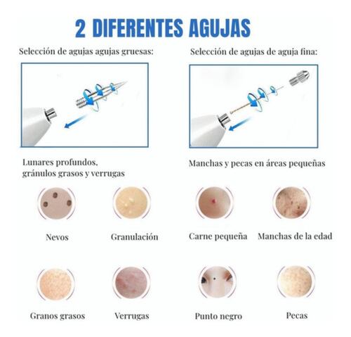 Pluma Verrugas Pecas Lunares Blanco con Azul