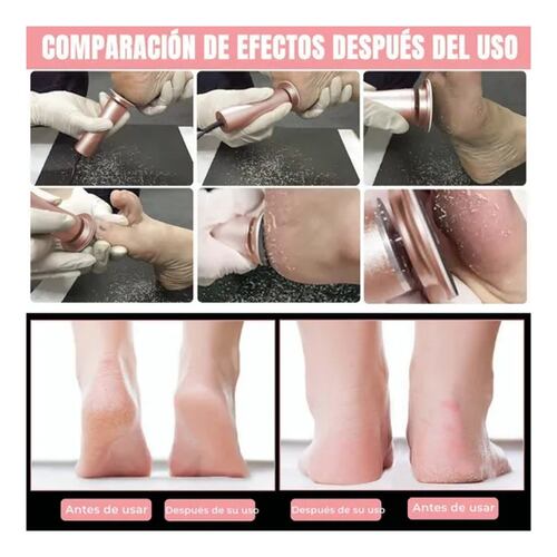 Máquinas Exfoliadoras Removedor De Callos Lima Para Pies