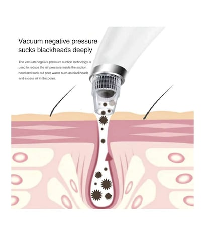 Limpiador de Poros  Facial Extractor Puntos Negros