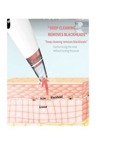 Limpiador de Poros  Facial Extractor Puntos Negros