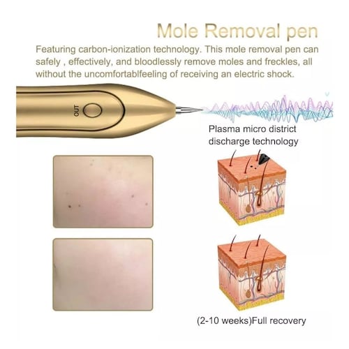 Cauterizador Quita Manchas Pecas Verrugas Tatuajes Con Luces Dorado