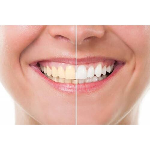 Blanqueador Dental Carbón Activado 100% NATURAL