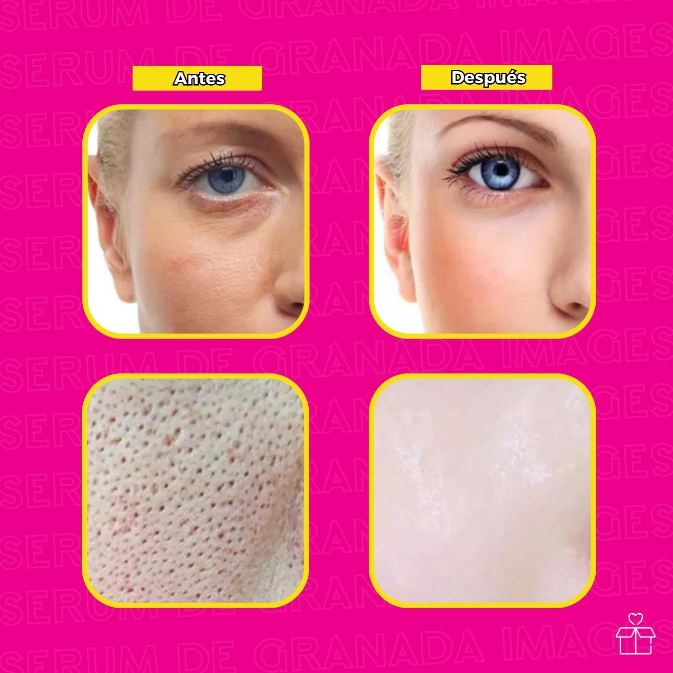 Serum Granada Anti Manchas.