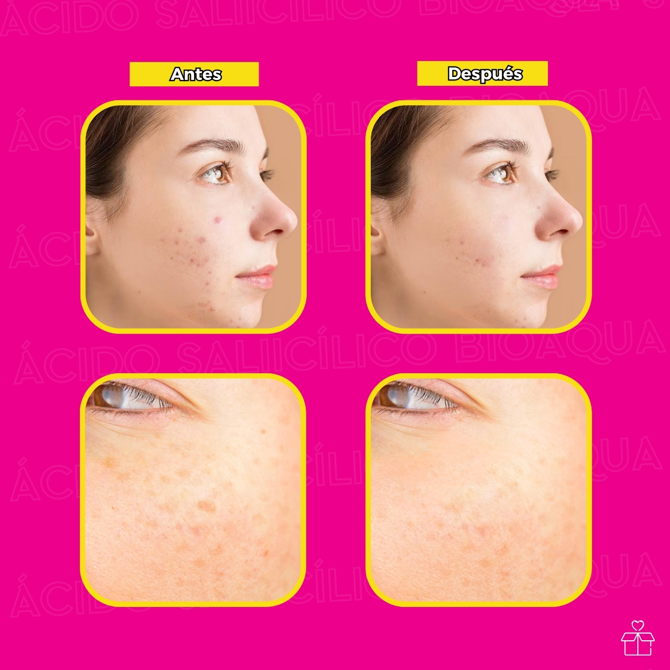 Serum Facial Con Acido Salicilico Anti Acne Bioaqua.