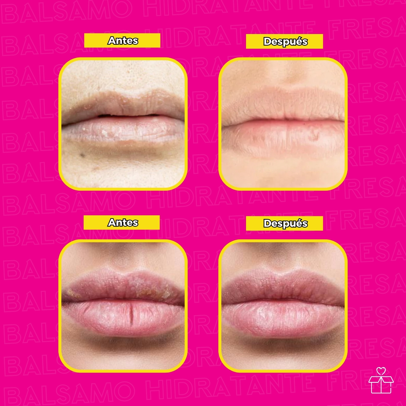 24 Bálsamos Hidratantes de Fresa para Labios Resecos