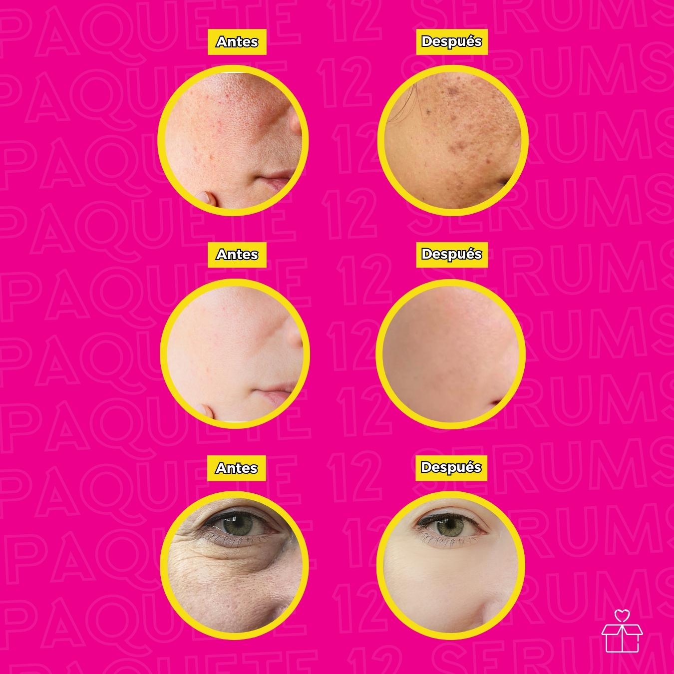 Set 12 Serums Arroz Blanco, Hydra B5 Ácido Hialurónico y Té Verde..