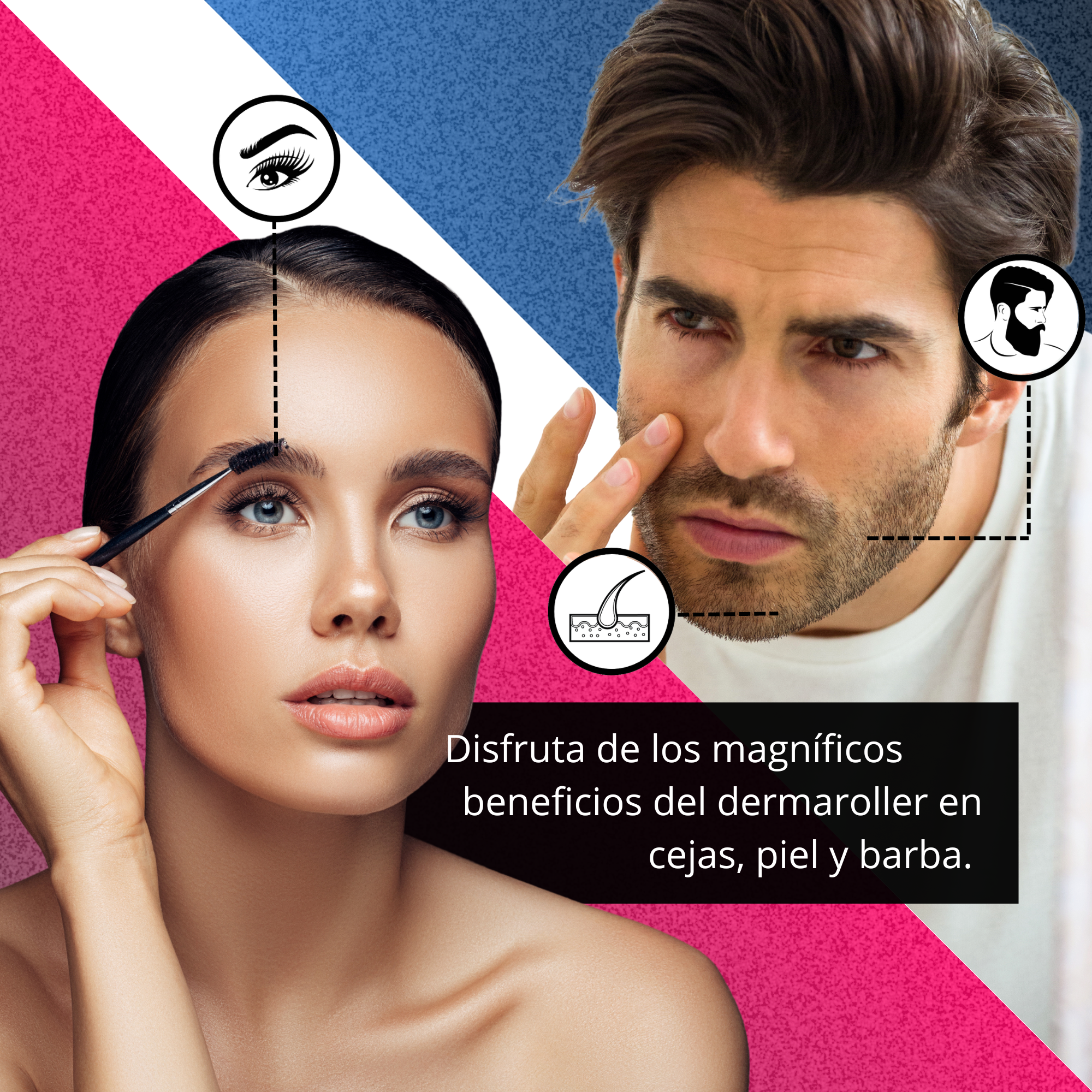 DERMAROLLER RODILLO PARA BARBA SYSTEM 0.5 MM AGUJA TITANIO.