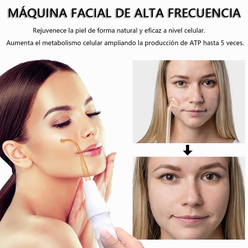 "Máquina De Terapia De Alta Frecuencia Para La Piel "