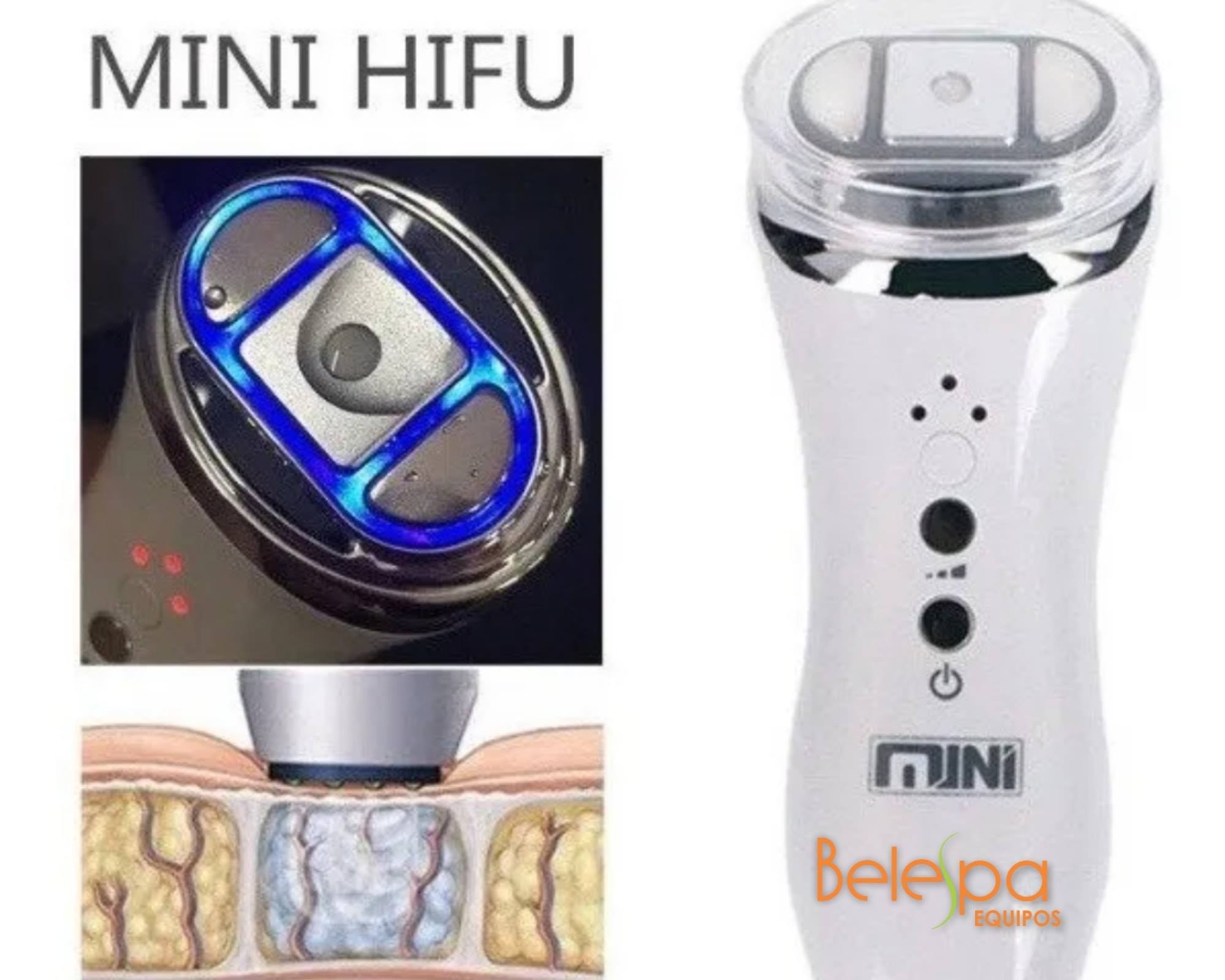 Mini Hifu Portatil Rejuvenecimiento Lifting  Facial 
