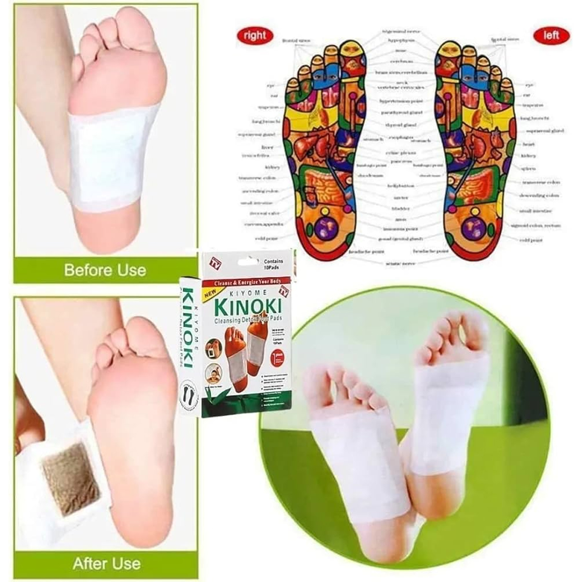 100 Parches Desintoxicantes Cuerpo Kinoki Pies