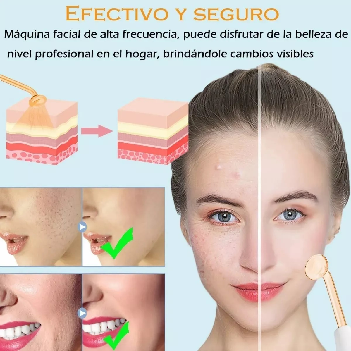 Kit Terapia Piel Alta Frecuencia Facial Blanco