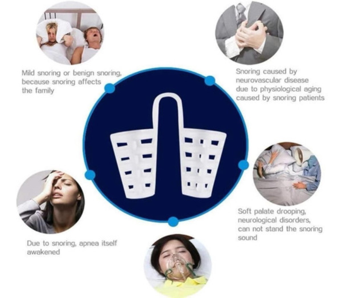 Dilatador Nasal Dispositivo Anti Ronquidos De Silicona 8 Pzs blanco