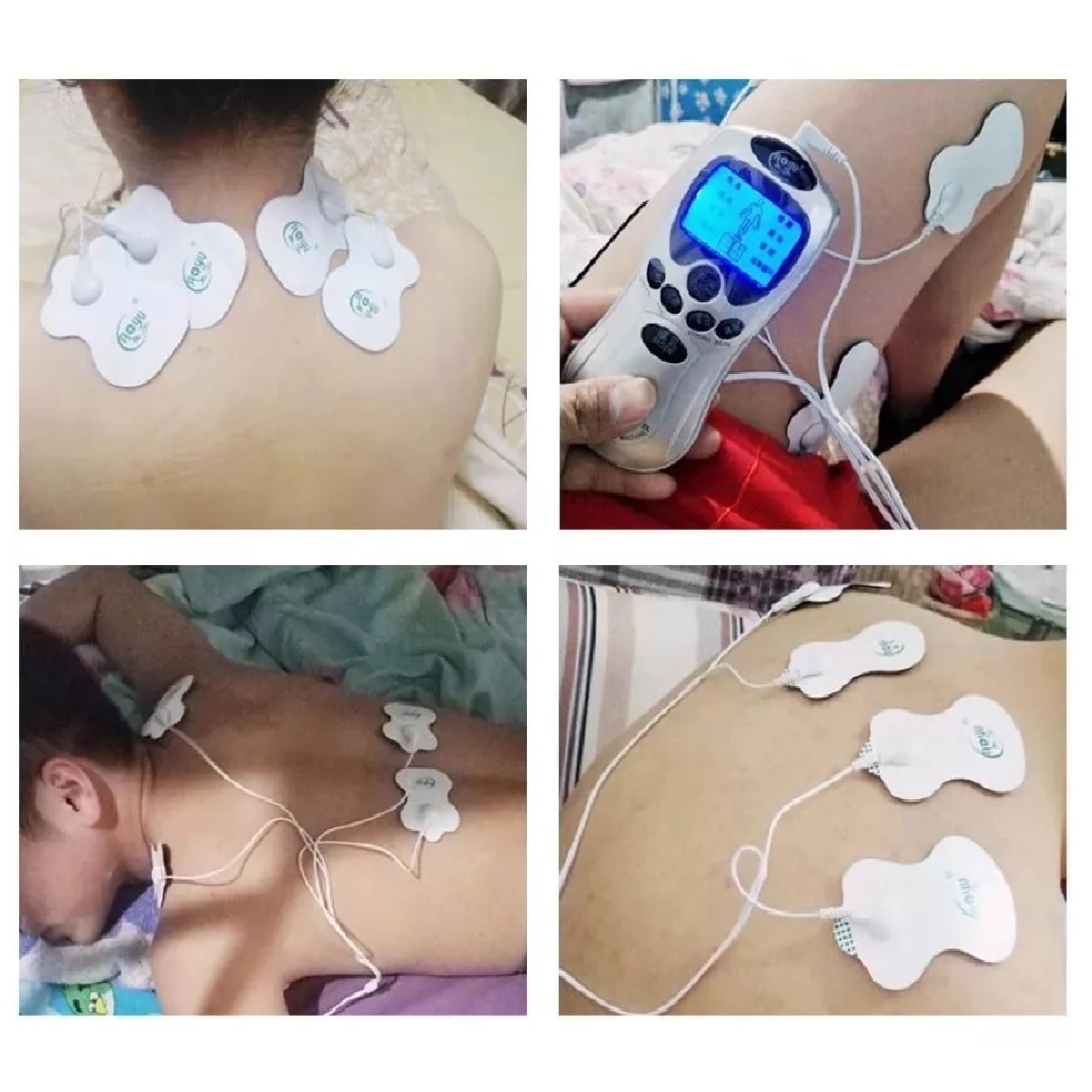 50 Pads Electrodos Parches Para Electroestimulador Tens Ems