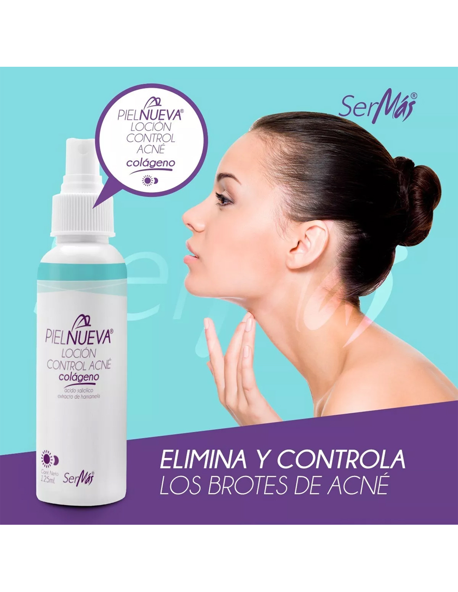 Loción Control Acné Limpia Las Impurezas,espinillas,barros.