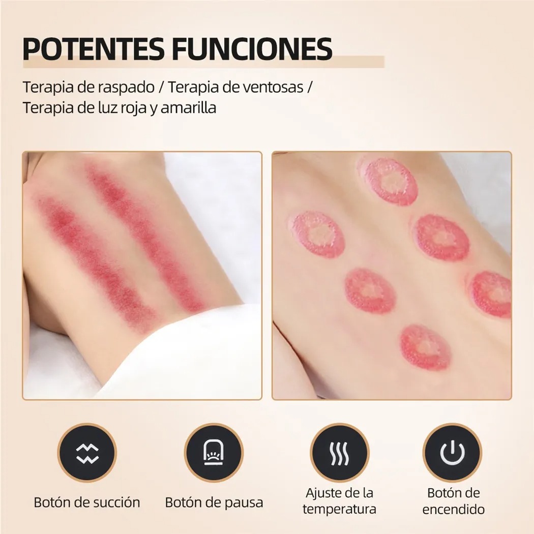 Ventosa Terapéutica Eléctrica De Masaje Cupping Inteligente