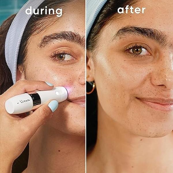 Gillette Venus Mini Facial Hair Remover for Women Face, Portable Electric Shaver/Razor, Face Hair Removal for Women, Dermaplaning Tool, Trimmer