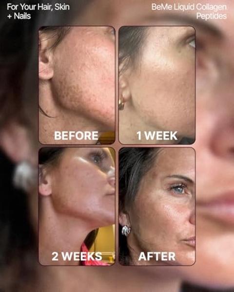 BeMe BeRadiant Liquid Collagen Peptide for Hair, Skin & Nails with 2X Faster Absorption – Clinically Tested – 2500mg Verisol® Hydrolyzed Collagen Supplements for Women with Biotin,