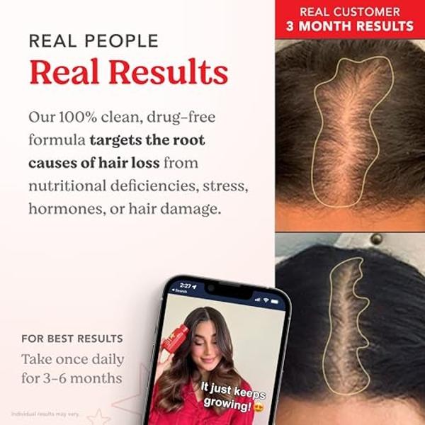 HAIRtamin Advanced Formula Hair Vitamins for Women & Men | Vegan 5000 Mcg Biotin Capsules Vitamin Supplement | Hair Skin and Nail Capsule Supplement to Promote Hair Growth & Thickn