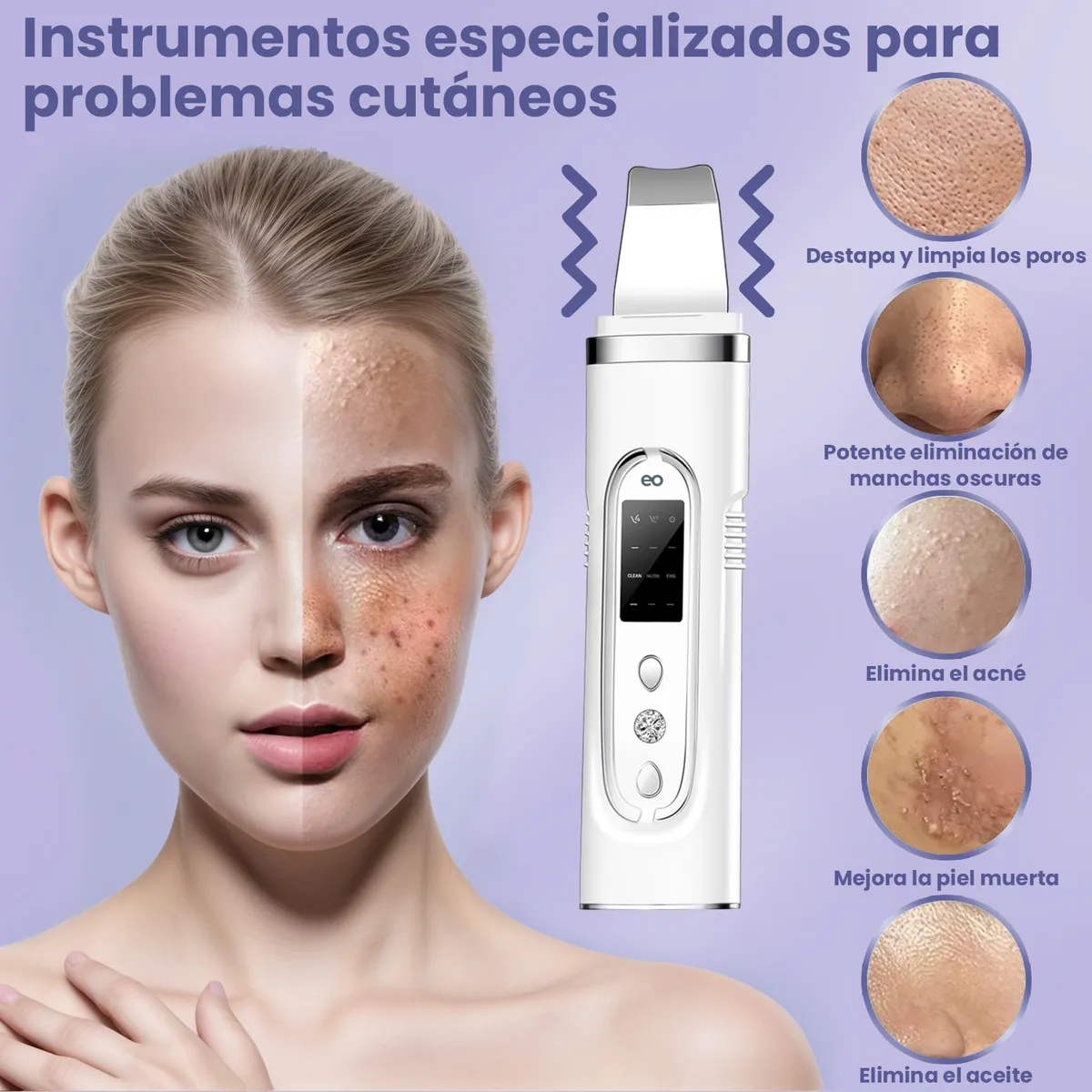Limpiador Ultrasónico Facial Para Eliminar Puntos Negros, Exfoliar, Acné Y Limpiar Poros