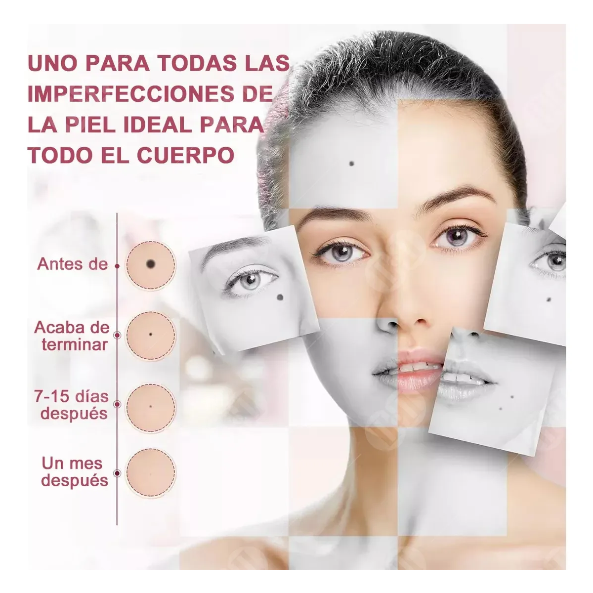 Herramienta Para Quitar Verrugas Pluma Cauterizador, Portátil Recargable