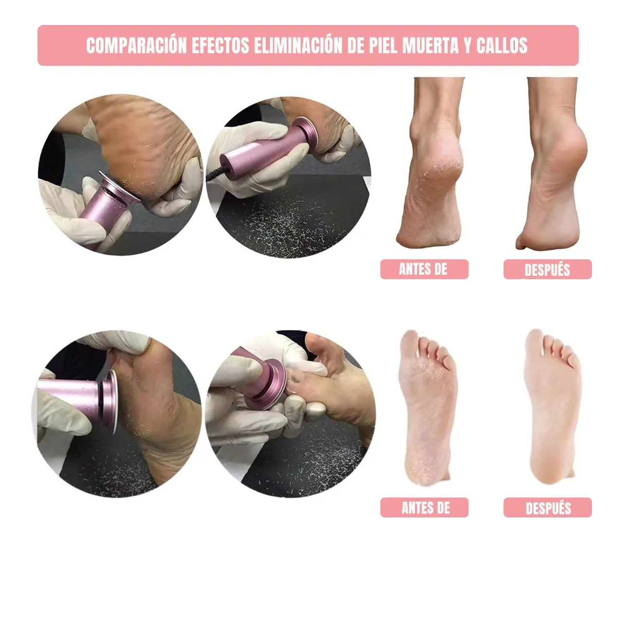 Removedor Callos Pedicure Exfoliante Lima Pies